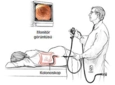 Kolonoskopi Nedir? Neden ve Nasıl Yapılır? Kolonoskopi Nedir? Neden ve Nasıl Yapılır?