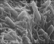 Bağırsak Florası Bozukluğu Belirtileri ve Tedavisi